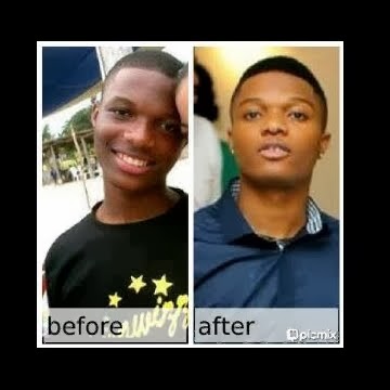 Wizkid-before and after.jpg